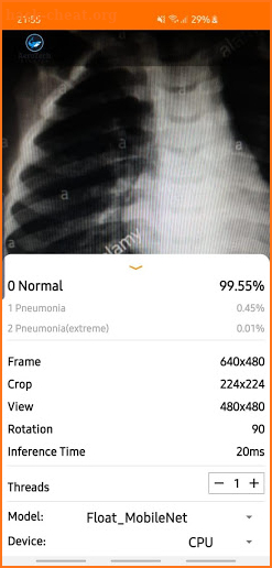 Chest X-Ray Classifier screenshot