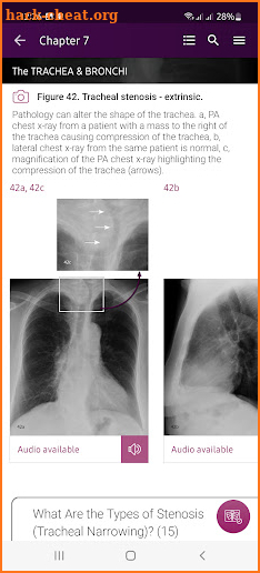 Chest X-Ray Interpretation screenshot