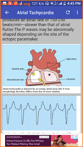 Clinical ECG Guide. screenshot