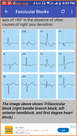 Clinical ECG Guide. screenshot