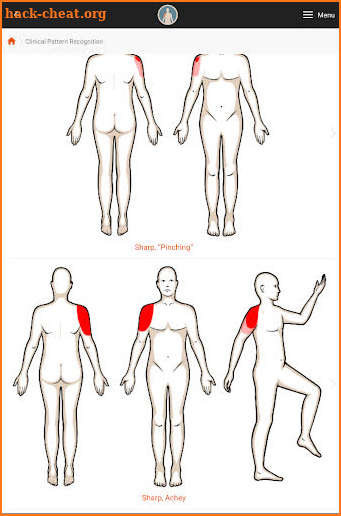 Clinical Pattern Recognition: Shoulder Pain screenshot