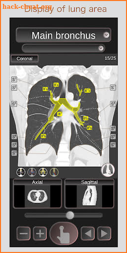CT Passport Chest / sectional anatomy / MRI screenshot