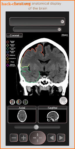 CT Passport Head/Brain / sectional anatomy / MRI screenshot