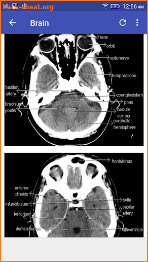 CT Scan Cross Sectional Anatomy screenshot