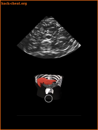 Deepscope Ultrasound Simulator screenshot