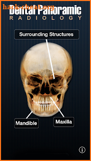 Dental Panoramic Radiology screenshot
