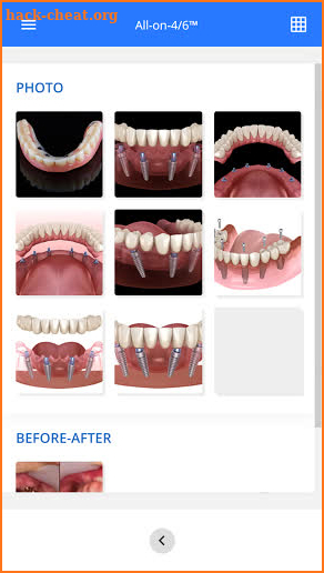 Dental Photos by DentiCalc screenshot
