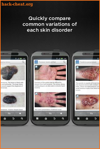 Dermatology DDx screenshot