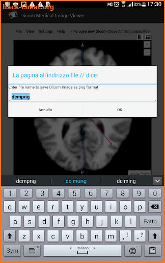 Dicom Medical Image Viewer screenshot