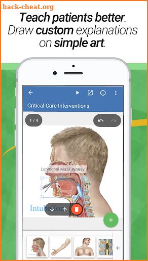 drawMD® - Free Patient Education screenshot
