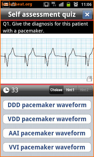 easy ECG training screenshot