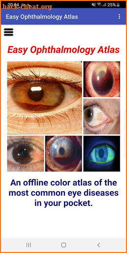 Easy Ophthalmology Atlas screenshot