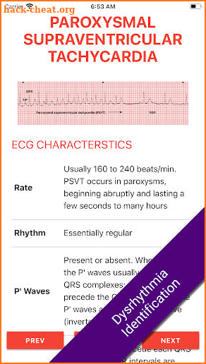 ECG FlashCards 2 - Reference App Most common EKGs screenshot