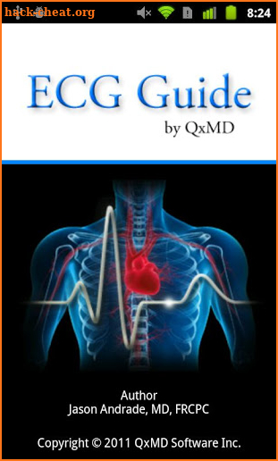 ECG Guide by QxMD screenshot