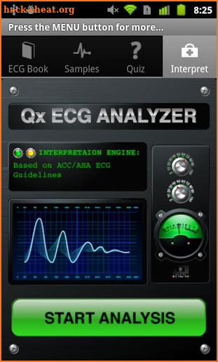 ECG Guide by QxMD screenshot
