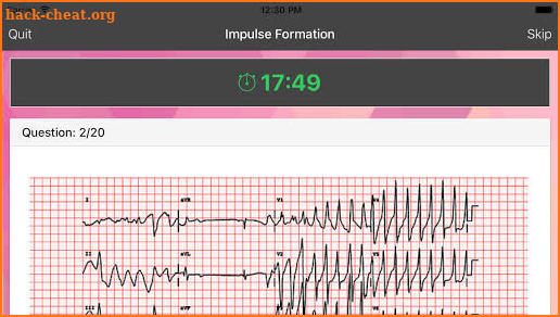 ECG Master: Electrocardiogram Quiz & Practice screenshot