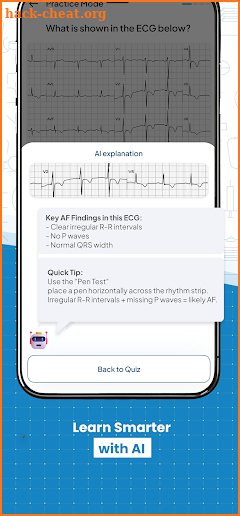 ECG Practice screenshot