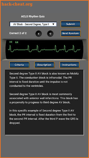 ECG Rhythm and Pulse screenshot