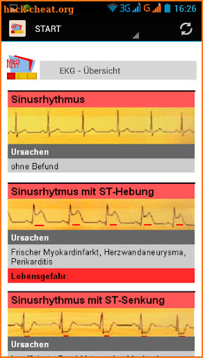 EKG-Monitoring screenshot
