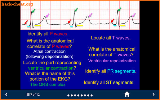 EKG - SecondLook screenshot