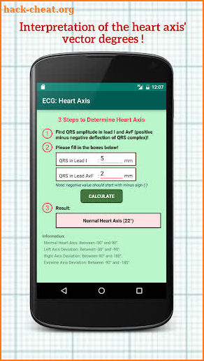 Electrocardiogram (ECG) Rhythm App: Heart Axis screenshot