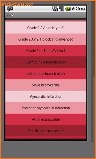 Electrocardiogram ECG Types screenshot