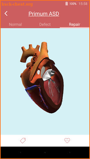 eMurmur Heartpedia screenshot