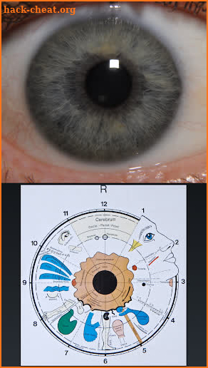 Eye Diagnosis screenshot