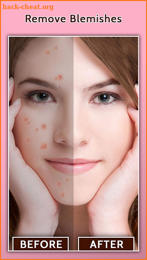 Face Blemish Remover - Smooth Skin & Beautify Face screenshot