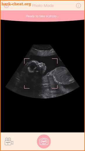 Fetus Camera screenshot