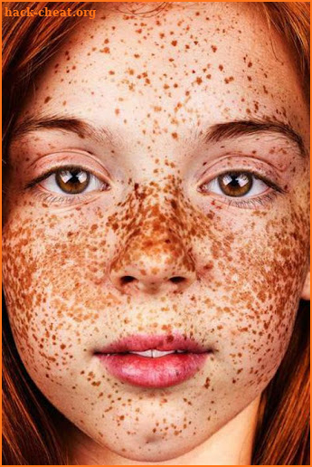 freckles tips screenshot