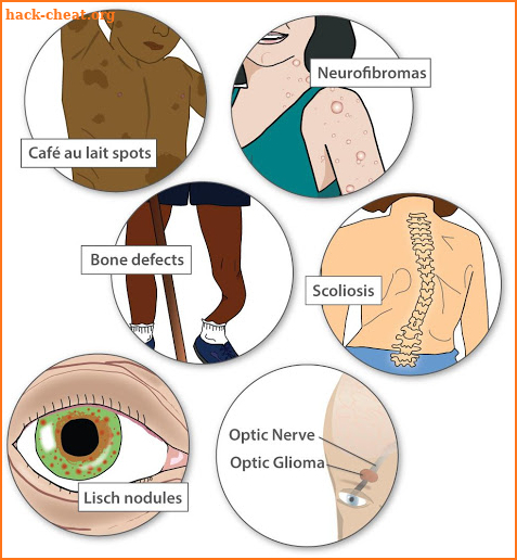 Genetic Health Disorders screenshot