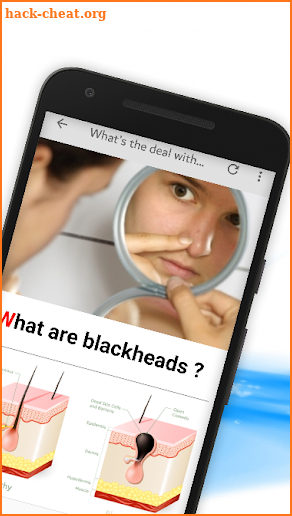 Get Rid Of Blackheads Naturally - 12 Home Remedies screenshot