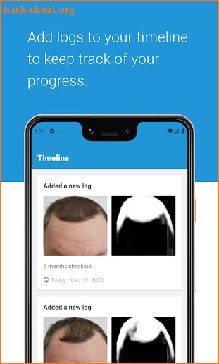 HairLog: Track Your Hair Regrowth screenshot