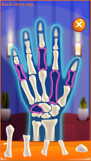 Hand Doctor Hospital Games for Kids screenshot