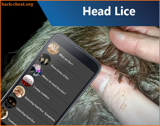 Head Lice screenshot