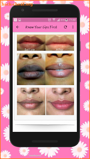 How To Get Soft Pink Lips Naturally - Lip Care screenshot