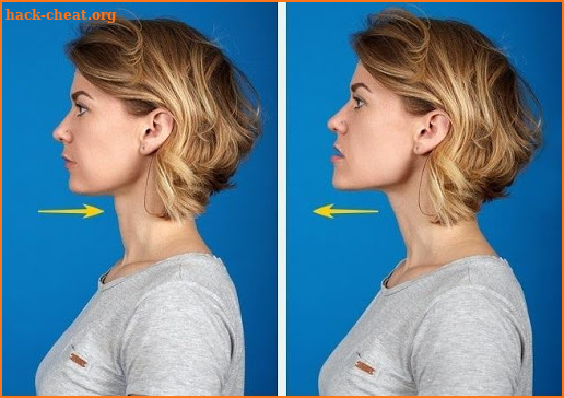 How to remove the second chin screenshot