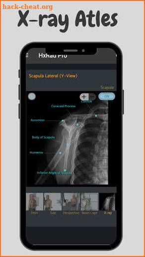 Hx Radiography Pro - Mobile Guide for Radiography screenshot
