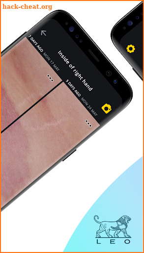Imagine – Eczema Tracking screenshot