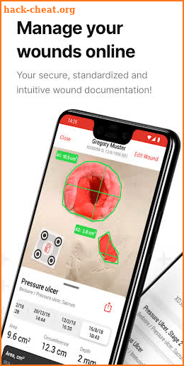 imitoWound - Digital Woundcare screenshot
