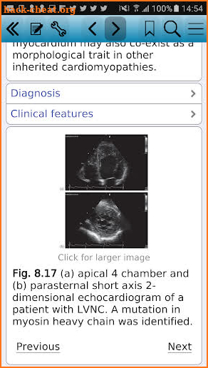 Inherited Cardiac Disease screenshot
