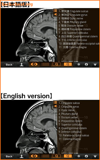 Interactive CT and MRI Anatomy screenshot