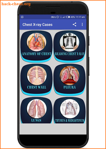 Interpret Chest X-Ray With 100 Cases screenshot