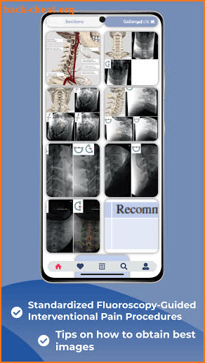 Interventional Pain App screenshot