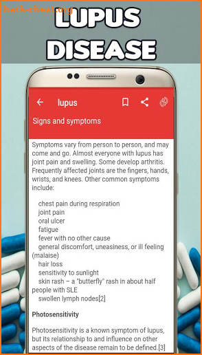 Lupus: Causes, Diagnosis, and Treatment screenshot