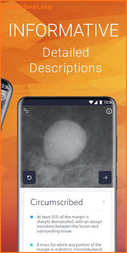 Mammography Assistant screenshot