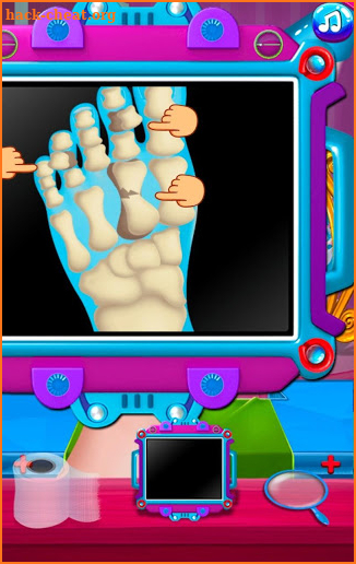 Miraculous Ladybug Nail_Foot Surgery Master Games screenshot