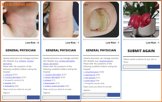 Model Dermatology for Skin Disease screenshot