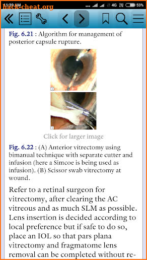 Moorfields Manual of Ophthalmology, 2nd Edn screenshot